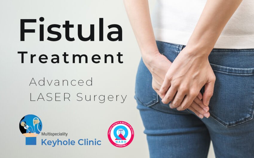 Fistula Treatment in Kochi - Get consulted at Keyhole Clinic, Metro Pillar No. 448, Near Lulu Mall, Kochi