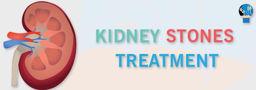 Kidney Stones Treatment