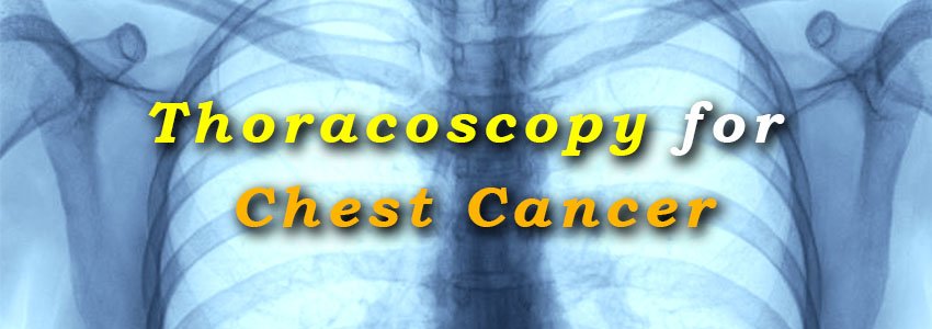 Thoracoscopy for Chest Cancer