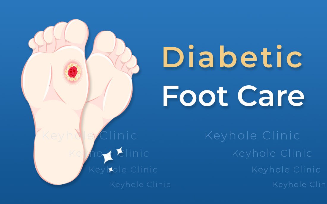 Diabetic Foot Treatment and Care - Diabetic Foot Ulcer Treatment, Chronic Wound Management,
Reconstructive Surgery, Angioplasty, Podiatry, Diabetology, Medications