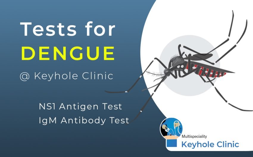 Tests for Dengue Fever at Edappally, Keyhole Clinic. NS1 Antigen Test, IgM Antibody Test. Consult General Physician with Test Results