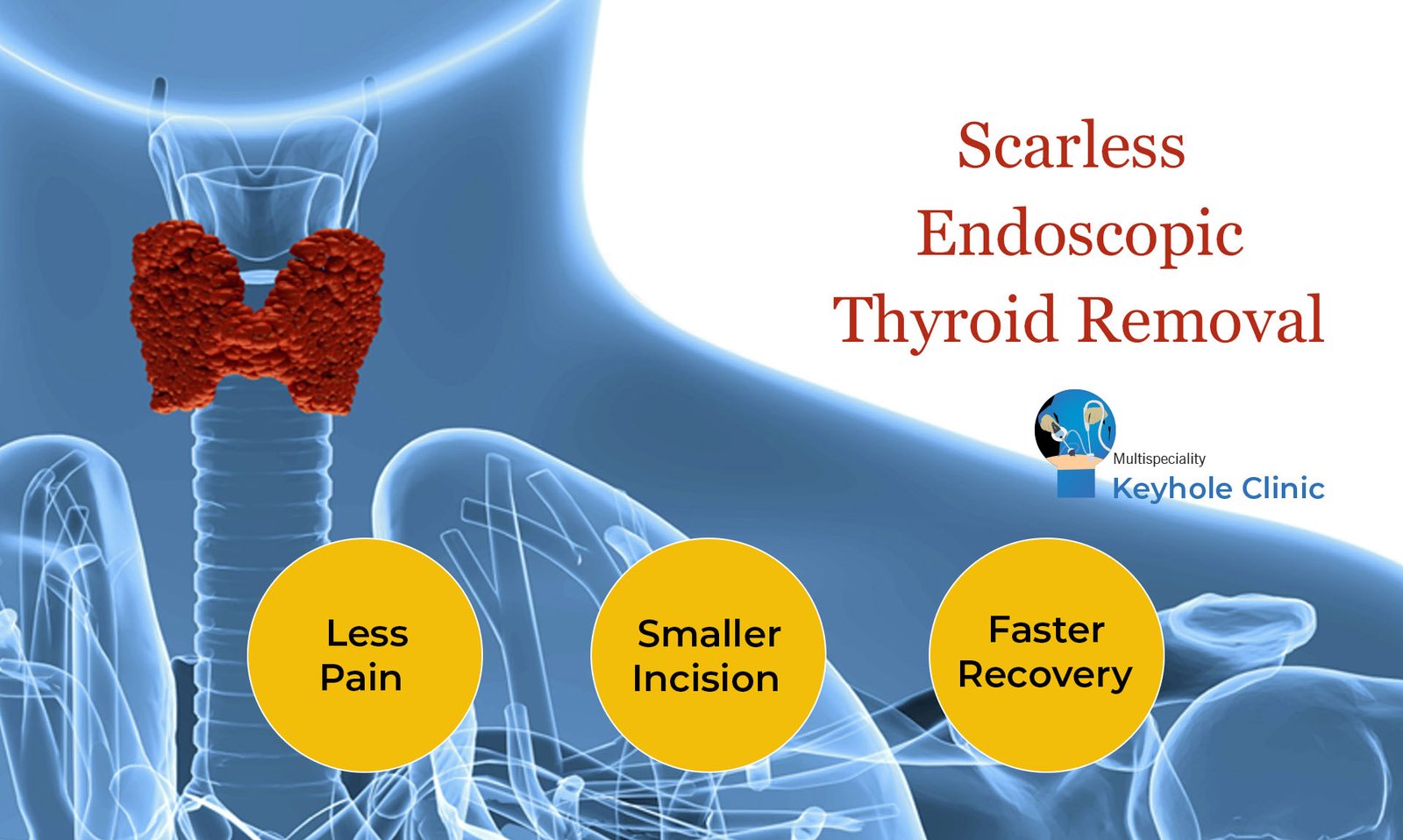 Keyhole Clinic - Endoscopic Thyroidectomy