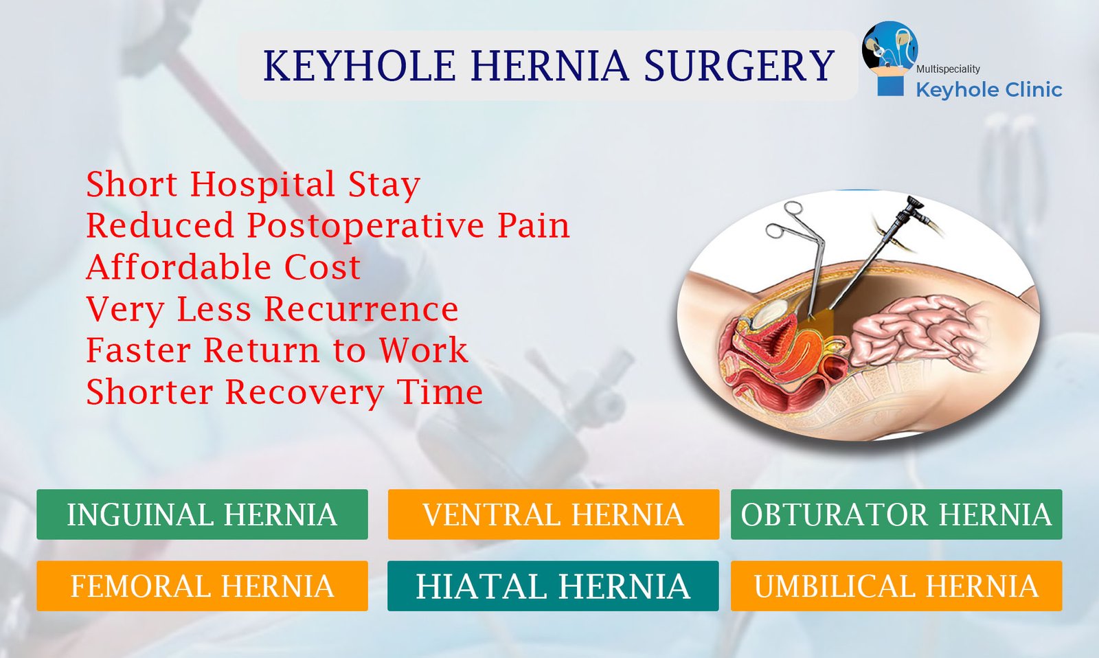 Keyhole Clinic - Keyhole Hernia Surgery