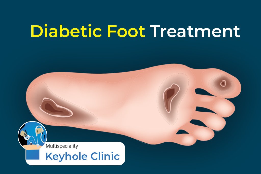 Dr Madhukara Pai provides Diabetic Foot Ulcer Treatment, Chronic Wound Management, Reconstructive Surgery, Angioplasty, Podiatry, Diabetology, Medications