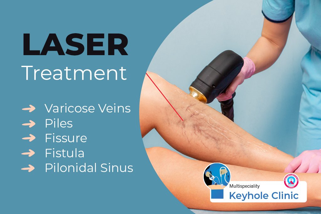 Dr Madhukara Pai provides LASER for treatment of Varicose Veins, Piles, Fissure, Pilonidal Sinus, Fistula