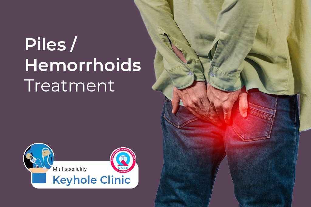 Piles Treatment - Different Treatment modalities for Piles / Hemorrhoids including LASER Treatment for Piles