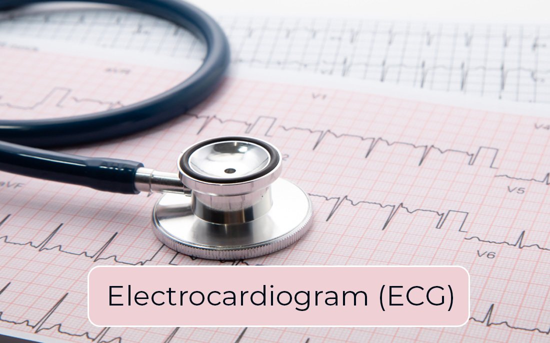 ECG Test (Electrocardiogram) at Keyhole Clinic 