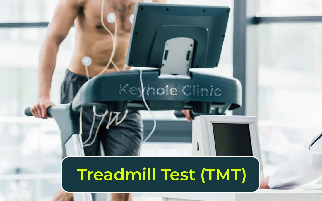 Treadmill Test (TMT) at Keyhole Clinic, Edappally, Kochi