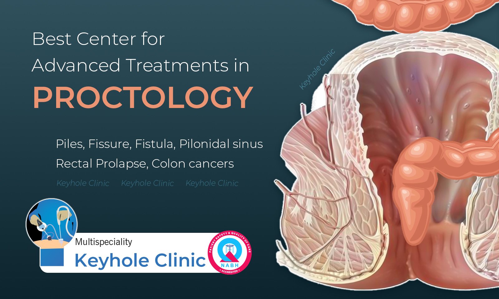 Best Proctologists in Kochi, Male and Female Proctologists offering Advanced LASER Treatment