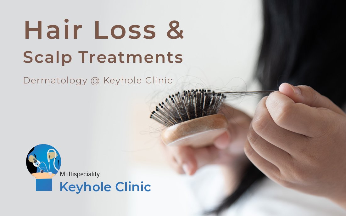 Hair Loss Treatments by Dermatologist available at Edappally Keyhole Clinic 