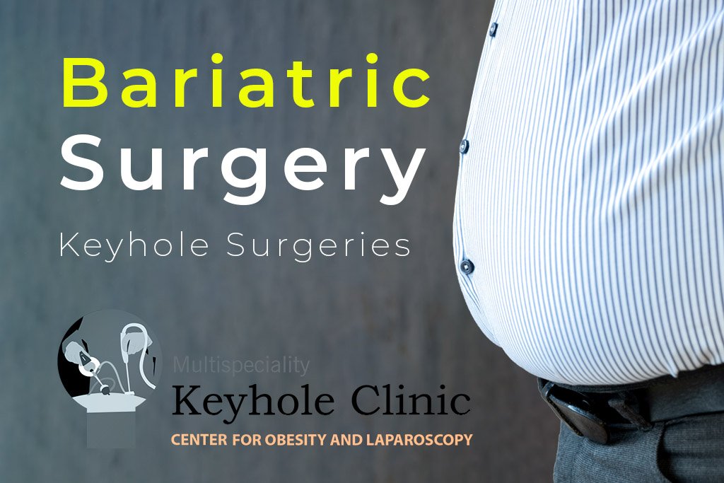 Bariatric Surgery 