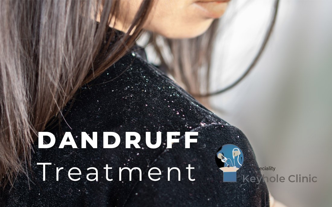 Acne Treatment by Dermatologist available at Keyhole Clinic 