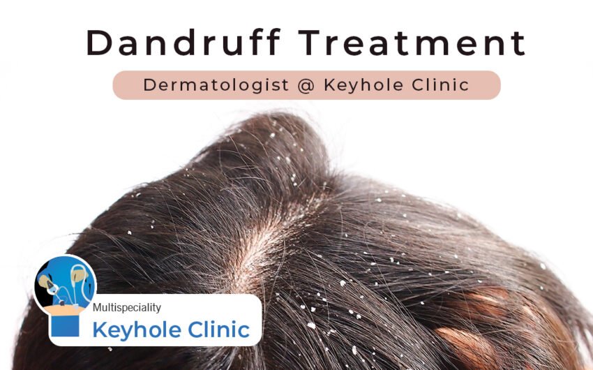 Dandruff Treatment in Edappally, Kochi - Dermatologist at Keyhole Clinic, Dr. Prabin P Dev