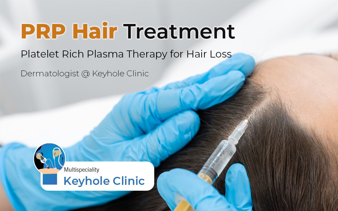 PRP Hair Treatment in Edappally, Kochi - Platelet Rich Plasma Therapy for Hair Loss